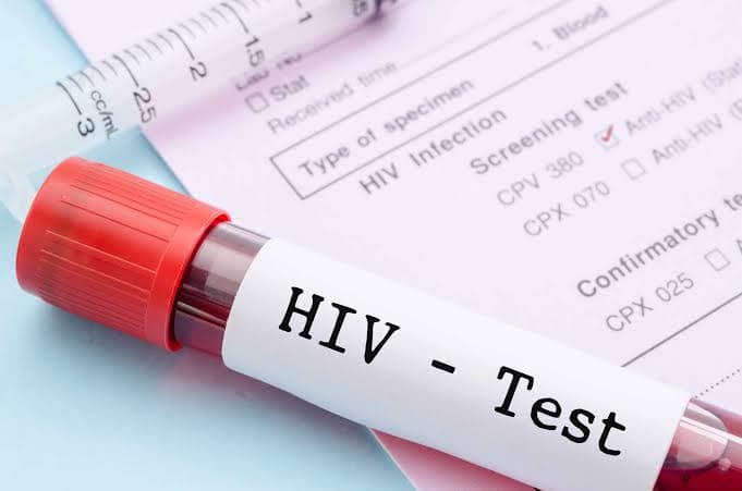 Alarming Rise in HIV Cases: Over 2,000 Reported in Sindh Province This Year